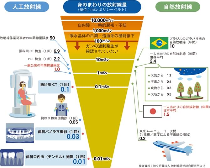 歯科用CT